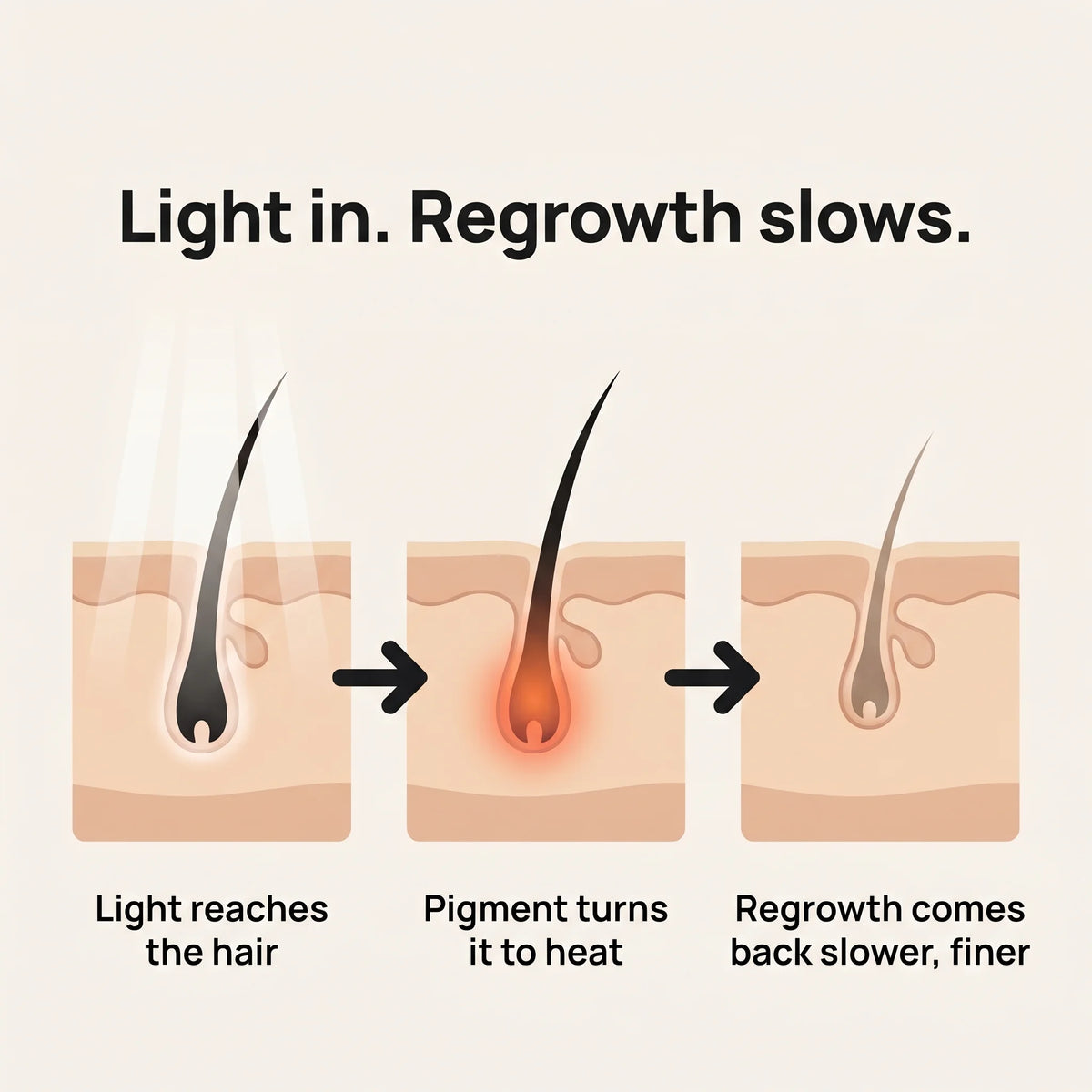 GRYD Lumin - IPL Hair Removal Device
