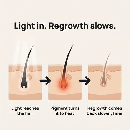 GRYD Lumin - IPL Hair Removal Device